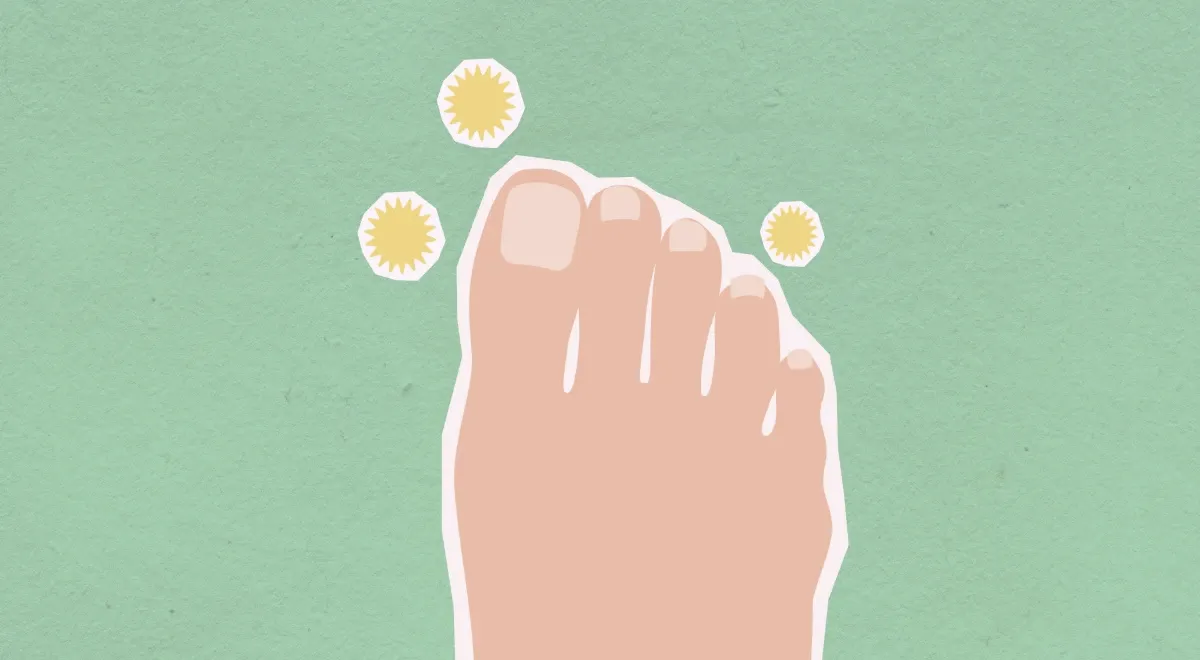 Traitement laser de la mycose des ongles